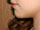 photo_neck_lift