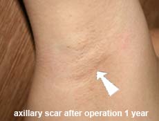 plastic-surgery-breast-augmentation 